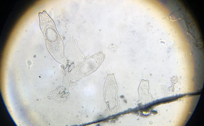 The Best Way To Dissolve Praziquantel & Treat Flukes - Hydrosphere ...